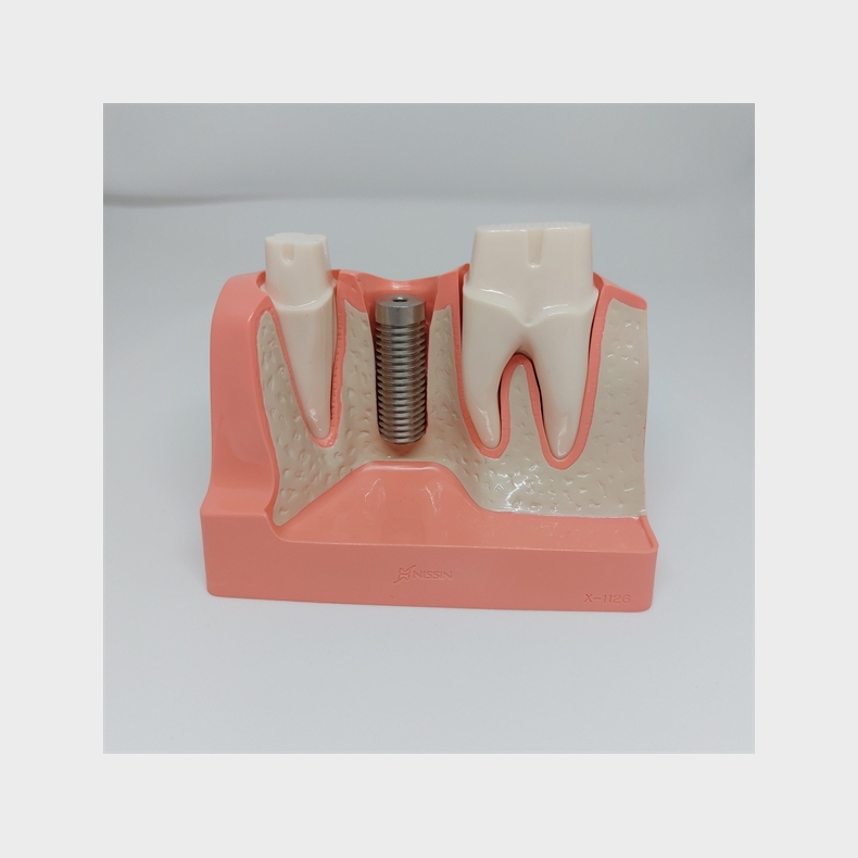 Maxi Implantat/Bro Studiemodel 